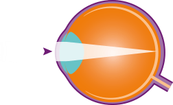 normal-eye-diagram-copy.png
